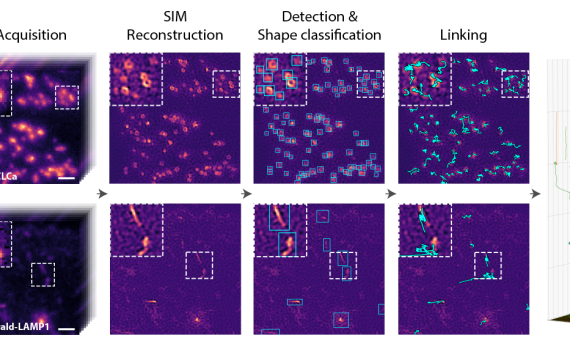 Machine Learning for Dynamic Inverse Problems in Microscopy